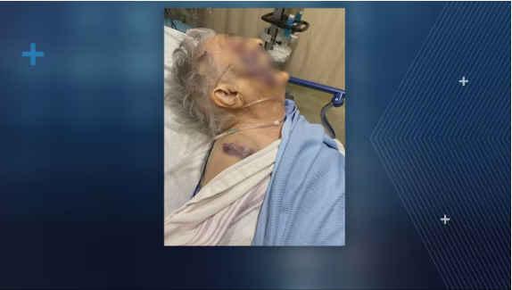 蒙特利尔老妇养老院跌倒后身亡  家属质疑护理疏忽报警